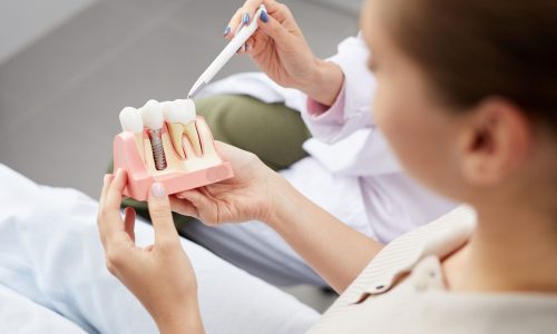 High angle view of unrecognizable young woman holding tooth model during consultation in dentists office, copy space