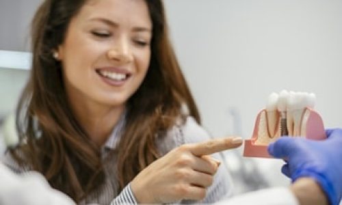 dental-implants-1-1